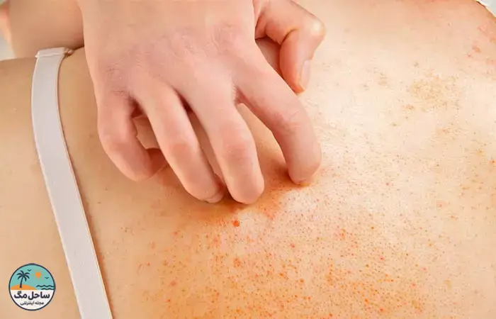 خطرات سلامتی (تنفسی و پوستی)